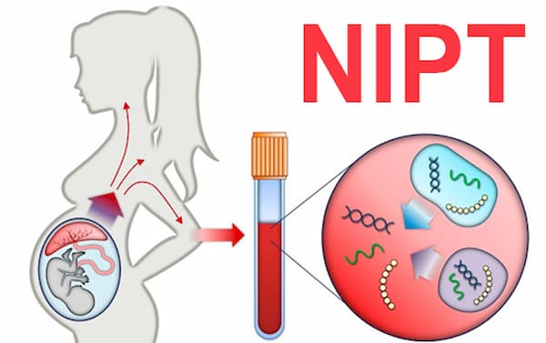 Xét Nghiệm NIPT Biết Trai Hay Gái Không & Cách Đọc Kết Quả