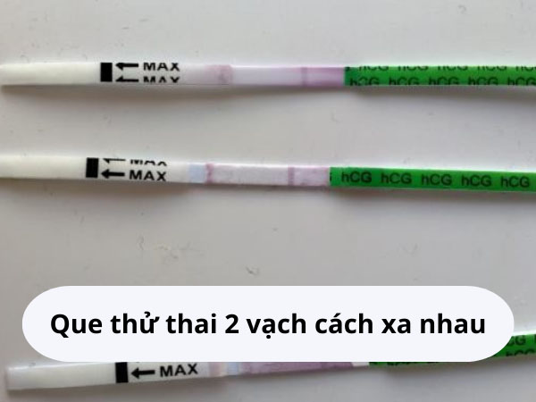 Kết quả que thử thai 2 vạch cách xa nhau